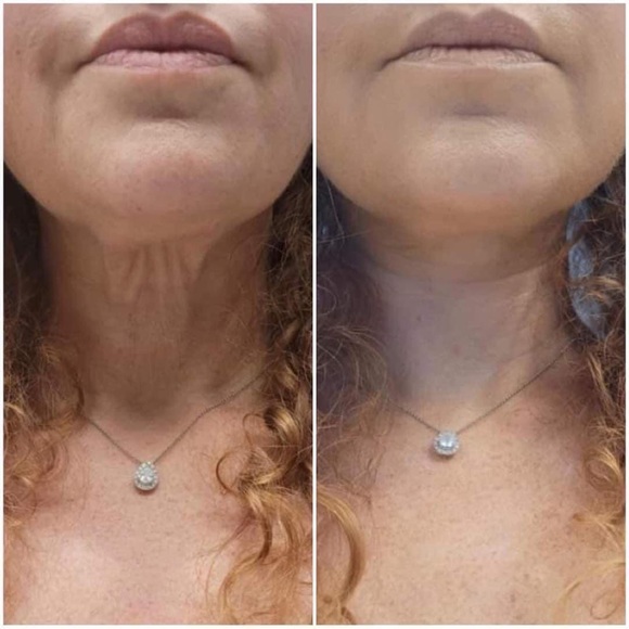 Nuskin’s best seller: the hibiscus and honey firming cream is available now. - Picture 6 of 11